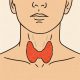 Thyroid Health: Key Insights