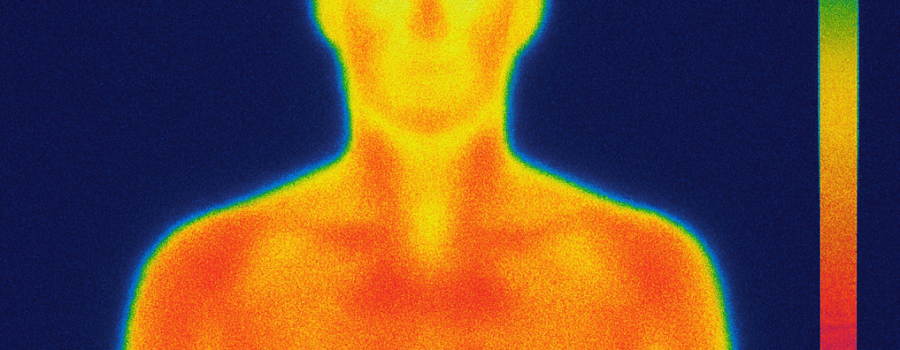 Thermography